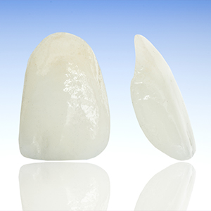 Porcelain veneer prior to placement