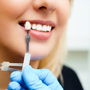 Woman's smile compared with tooth color chart