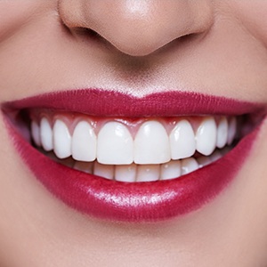 Closeup of flawless smile