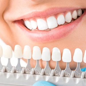 dentist matching the color of a patient’s tooth to a shade guide