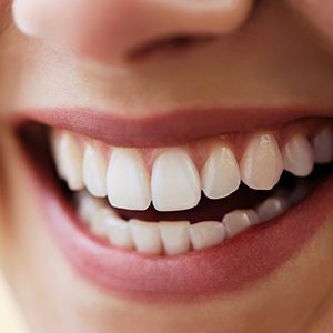 Closeup of healthy smile