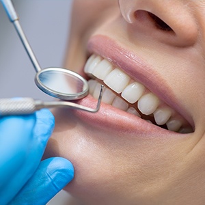 Closeup of smile during dental exam