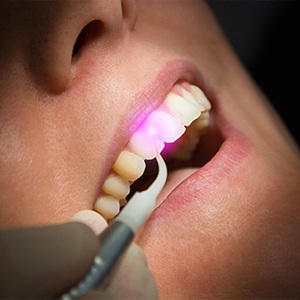 Closeup of patient receiving laser dentistry