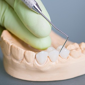 A person is holding a tooth pick and putting it in to the teeth of another