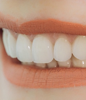 A close up of the teeth and smile of a person